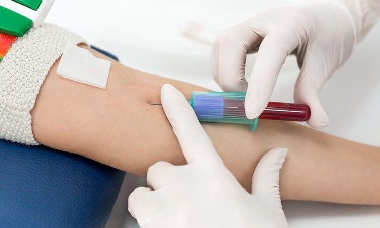 HGB trong xét nghiệm máu là gì? Chỉ số nói lên điều gì
